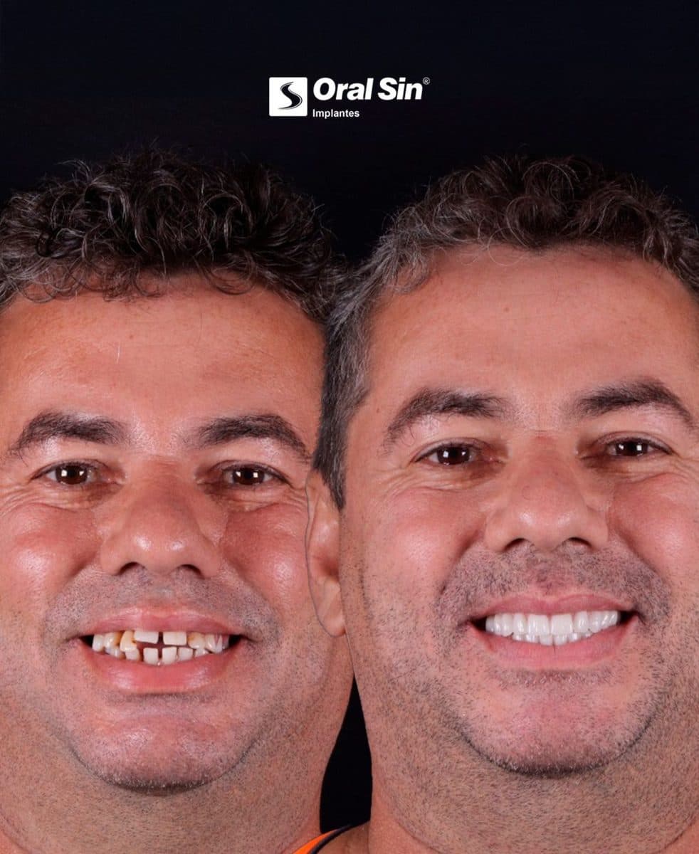 Gerson Silva